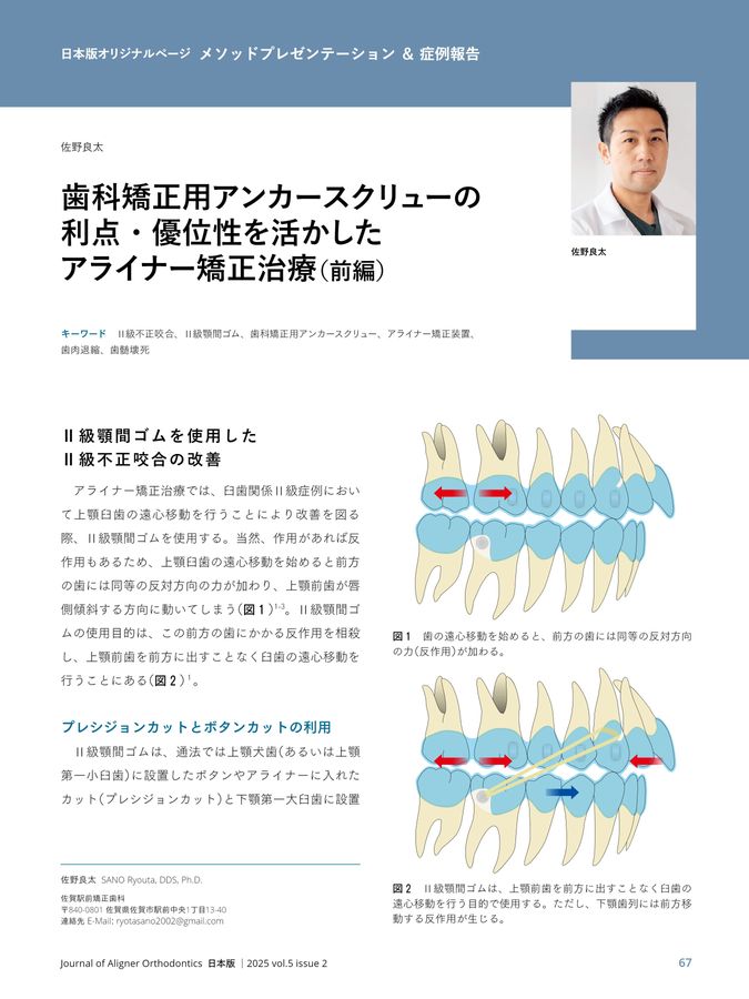 JAO［Journal of Aligner Orthodontics］日本版 2025年No.2