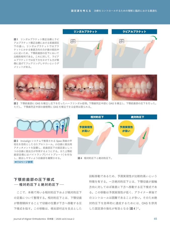 JAO［Journal of Aligner Orthodontics］日本版 2026年No.2