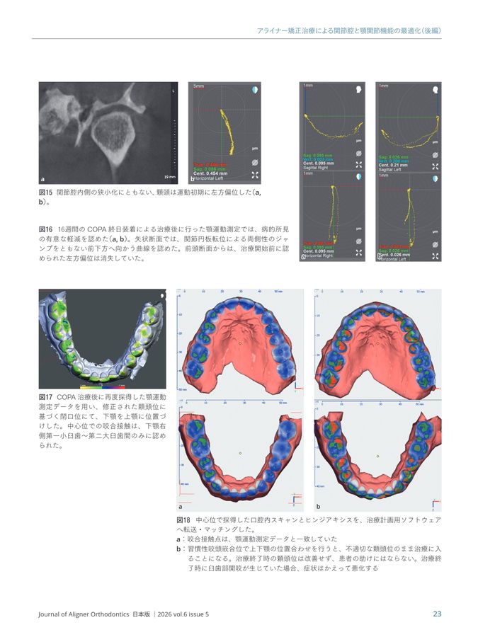 JAO［Journal of Aligner Orthodontics］日本版 2026年No.5