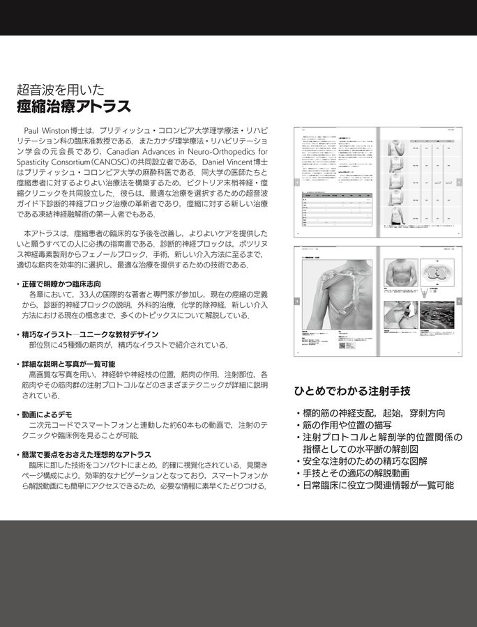 超音波を用いた痙縮治療アトラス
