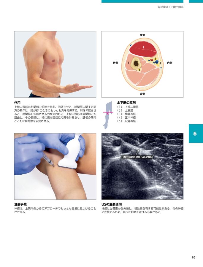 超音波を用いた痙縮治療アトラス : 標的筋への最適な施注のために 超音波を用いた痙縮治療アトラス