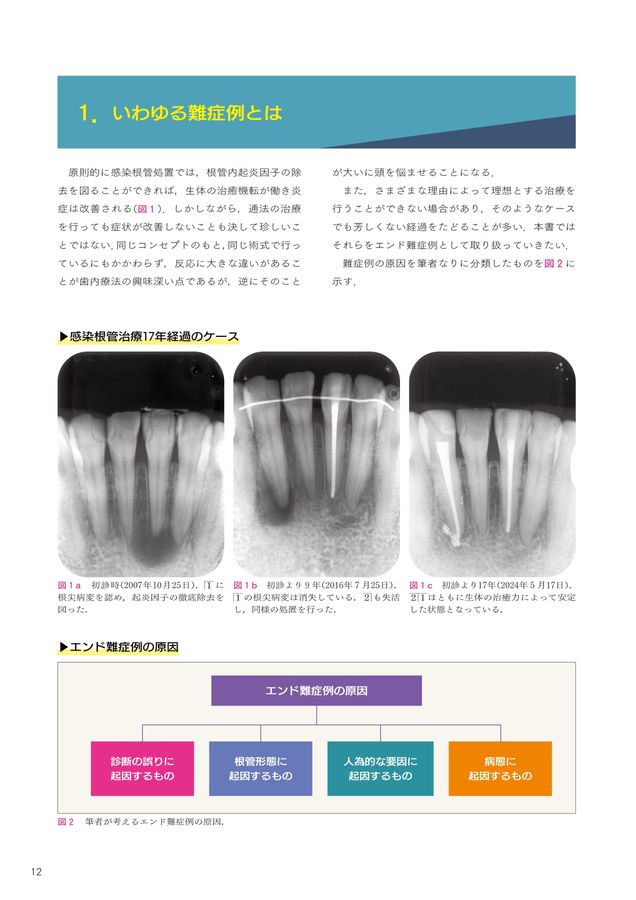 悩めるエンド難症例　診断のポイントとその対応 悩めるエンド難症例 診断のポイントとその対応