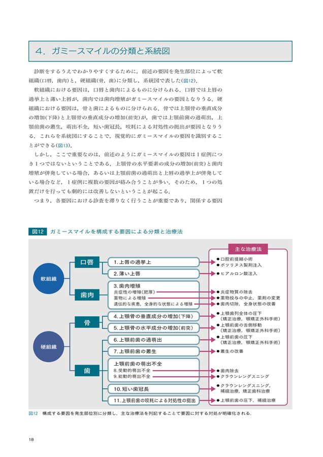 ガミースマイル
