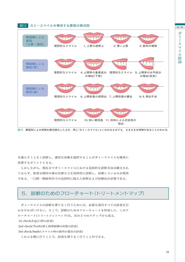 ガミースマイル : 11の要因 成功に導くトリートメントマップ ガミースマイル: 11の要因 成功に導くトリートメントマップ