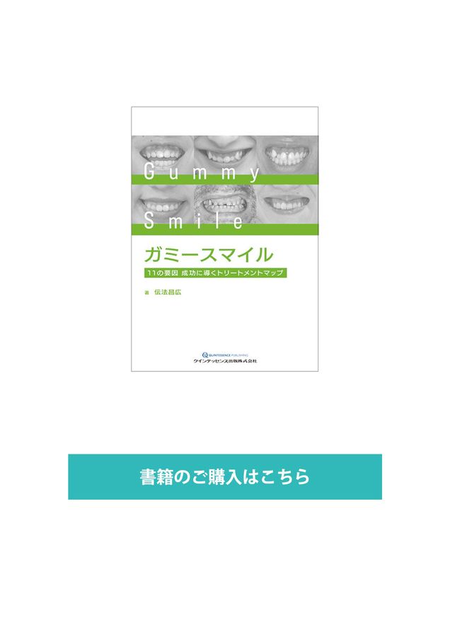 ガミースマイル