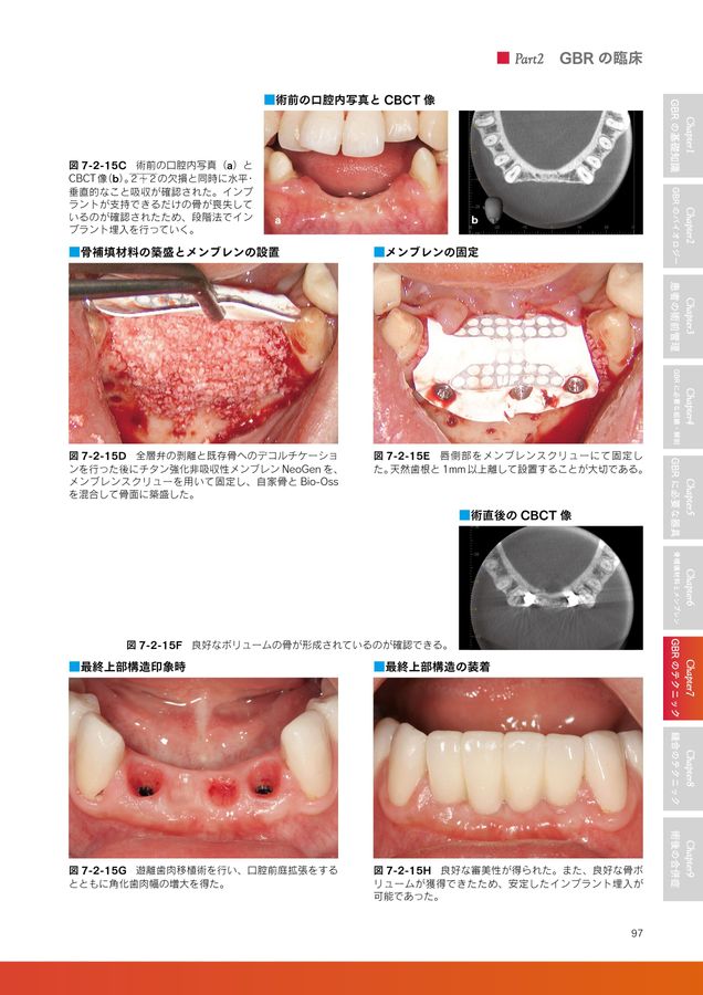 ベーシックGBR