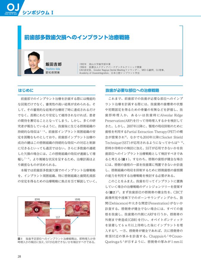 インプラント周囲軟組織のマネジメント 筒井昌秀臨床DVD3 インプラント周囲軟組織のマネジメント