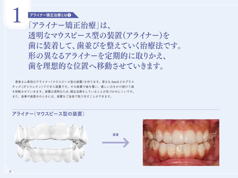 アライナー矯正治療受診ナビ