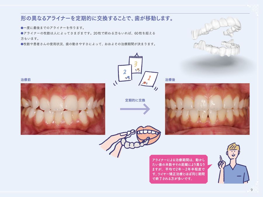 アライナー矯正治療受診ナビ