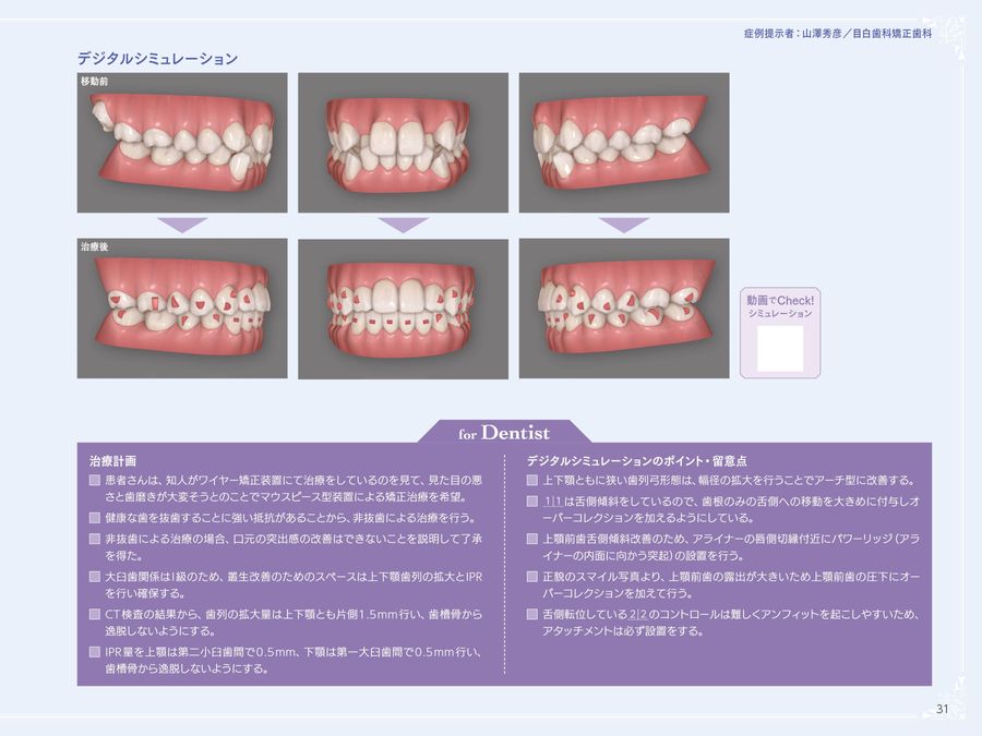 アライナー矯正治療受診ナビ