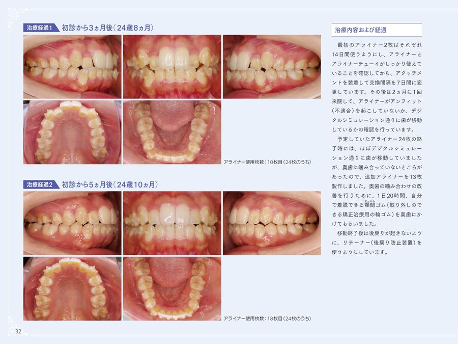 アライナー矯正治療受診ナビ