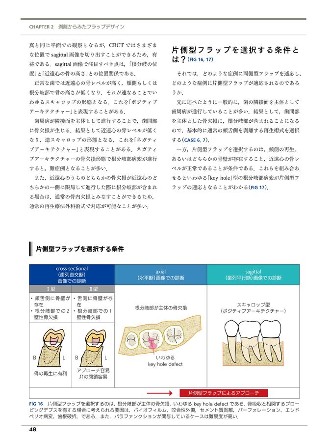 フラップデザイン　アドバンス編 最新のフラップデザインのコンセプトと術式 41-VDlXpokL._AC_SY200_QL15_.jpg