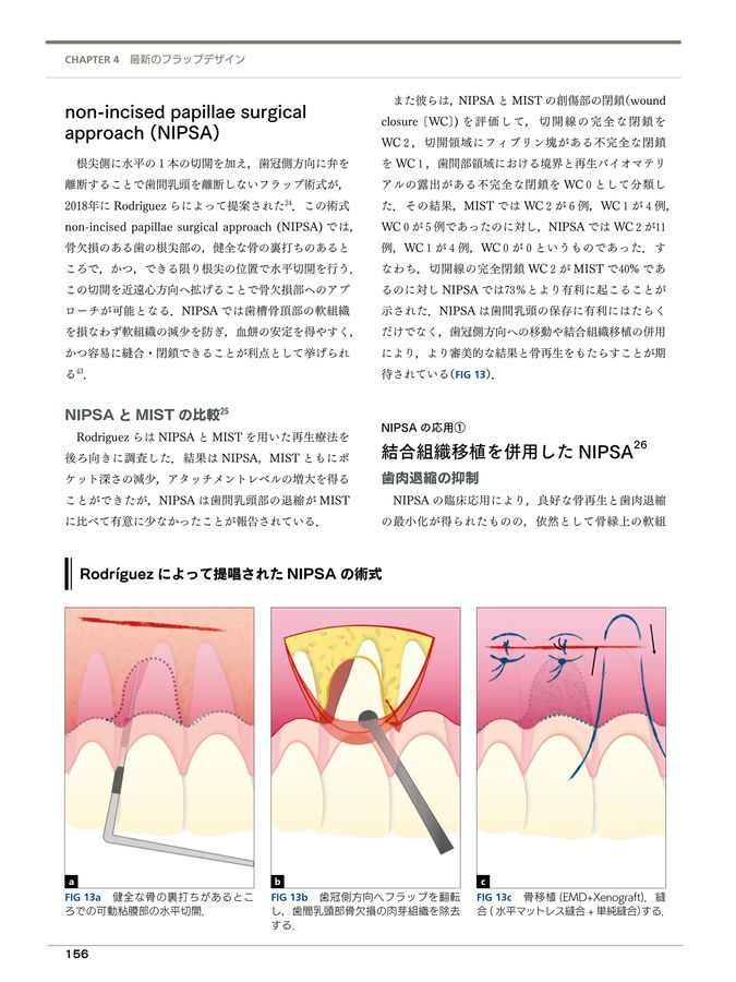 フラップデザイン　アドバンス編 最新のフラップデザインのコンセプトと術式 41-VDlXpokL._AC_SY200_QL15_.jpg