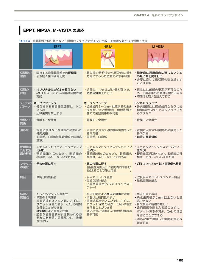 フラップデザイン アドバンス編