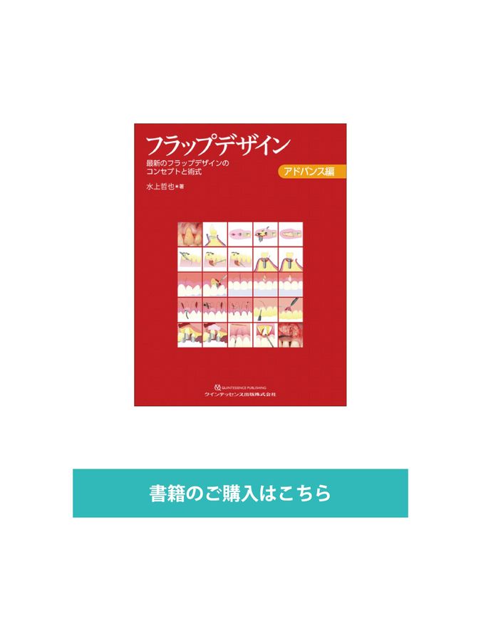 フラップデザイン アドバンス編