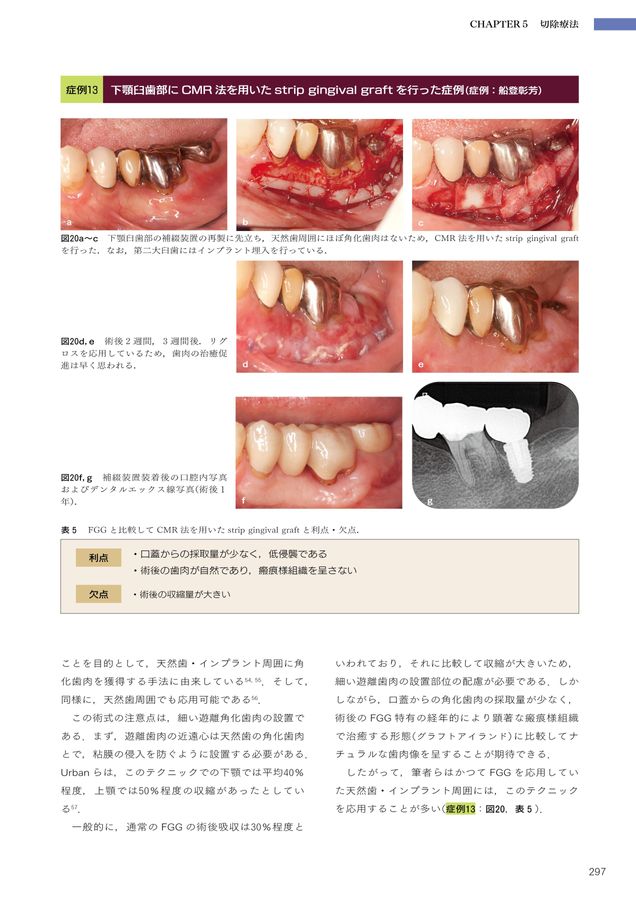 5-Dコンセンサス 歯の保存にこだわる