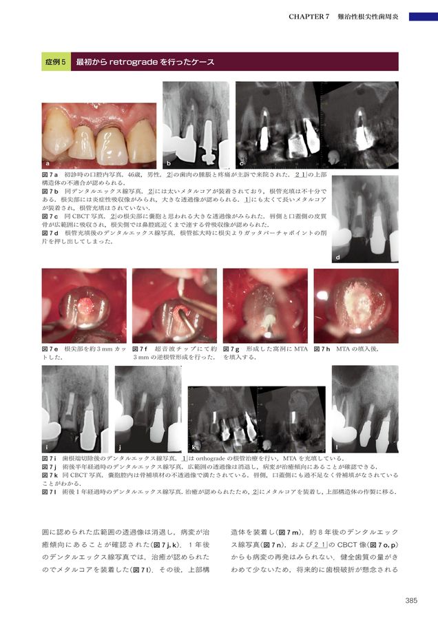 5-Dコンセンサス　歯の保存にこだわる 商品詳細ページ | メディカルブックセンター