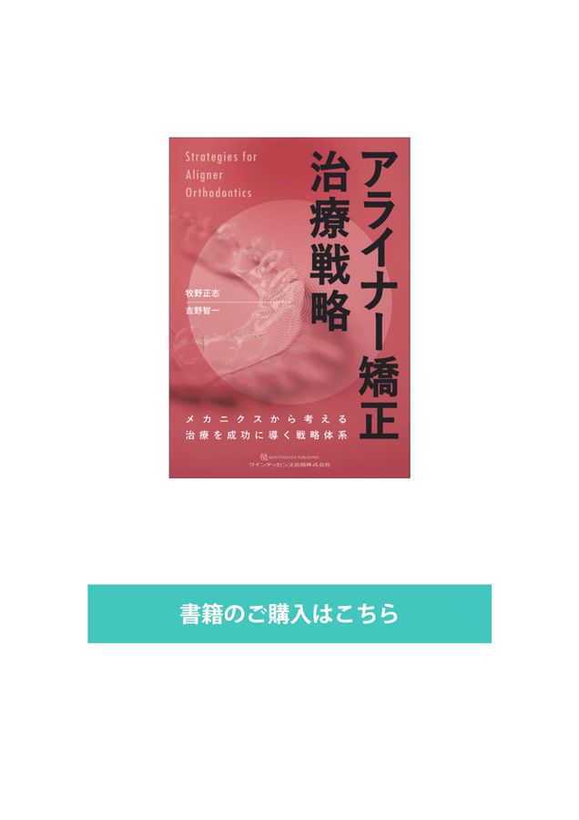 アライナー矯正 治療戦略 シエン社 | アライナー矯正治療戦略