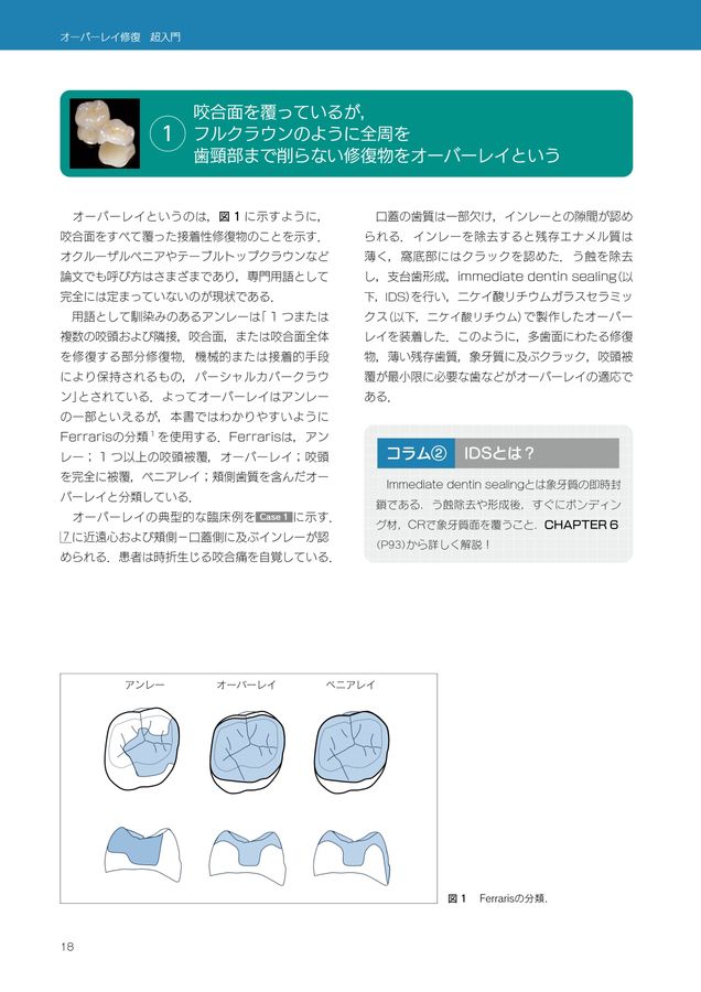 オーバーレイ修復 超入門
