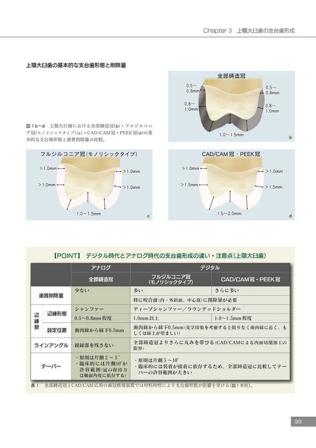 Amazon.co.jp: 必ず上達 歯冠修復(上) : 萩原 芳幸: 本