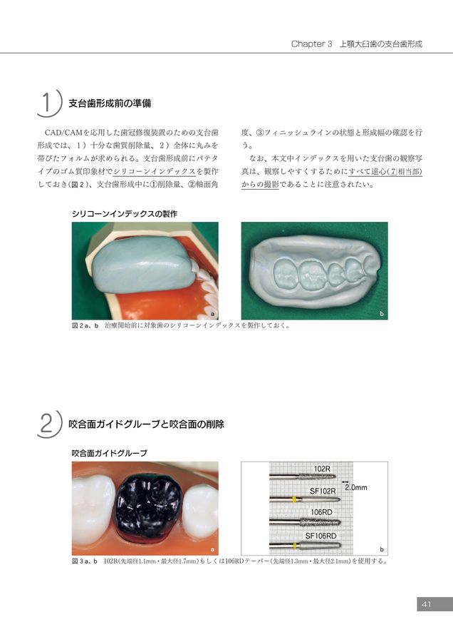 必ず上達 デジタル時代の歯冠修復