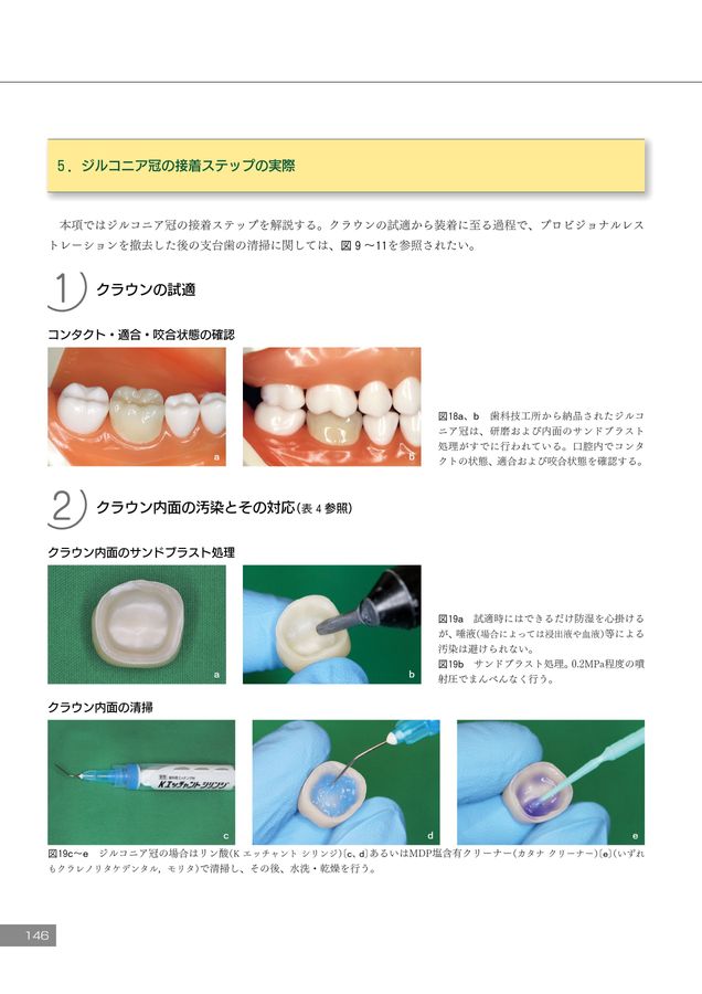 デジタル時代の歯冠修復 デジタル時代の歯冠修復
