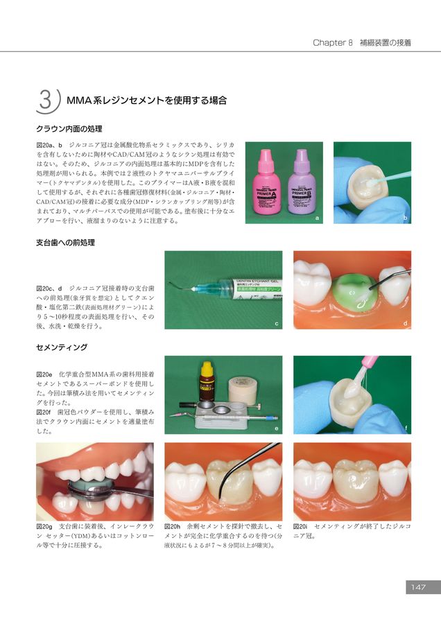 デジタル時代の歯冠修復 必ず上達 デジタル時代の歯冠修復 | 萩原芳幸 |本 | 通販 | Amazon