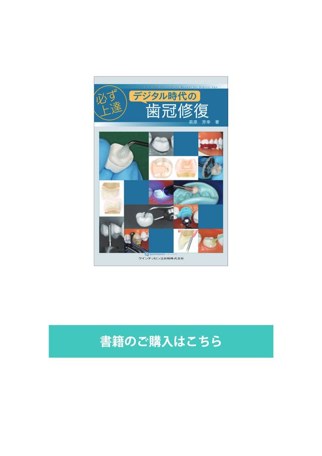 必ず上達 デジタル時代の歯冠修復