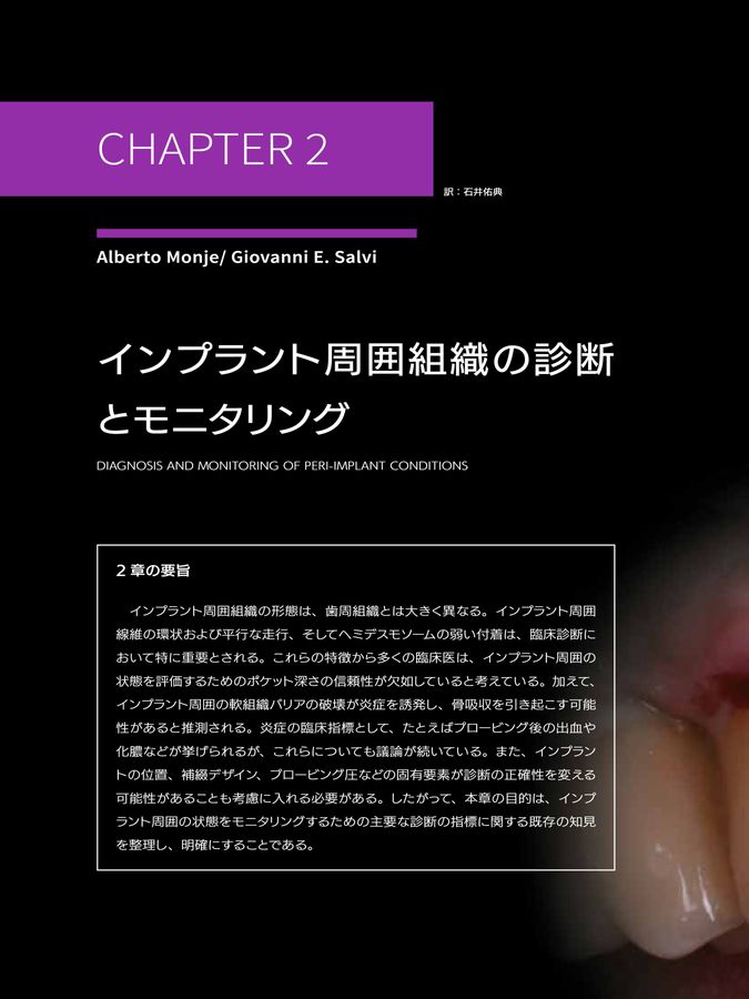 インプラント周囲炎を紐解く