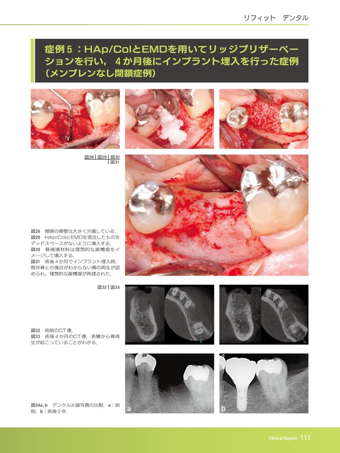 骨補填材料＆メンブレンYEARBOOK2025/2026