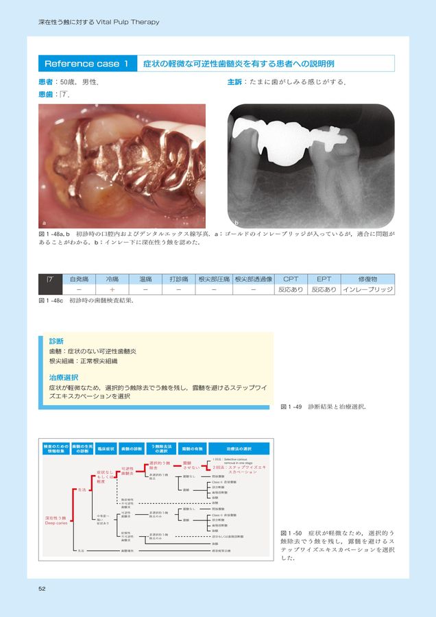 ⚠裁断済　深在性う蝕に対するVital Pulp Therapy　☆ ⚠裁断済 深在性う蝕に対するVital Pulp Therapy ☆ - メルカリ