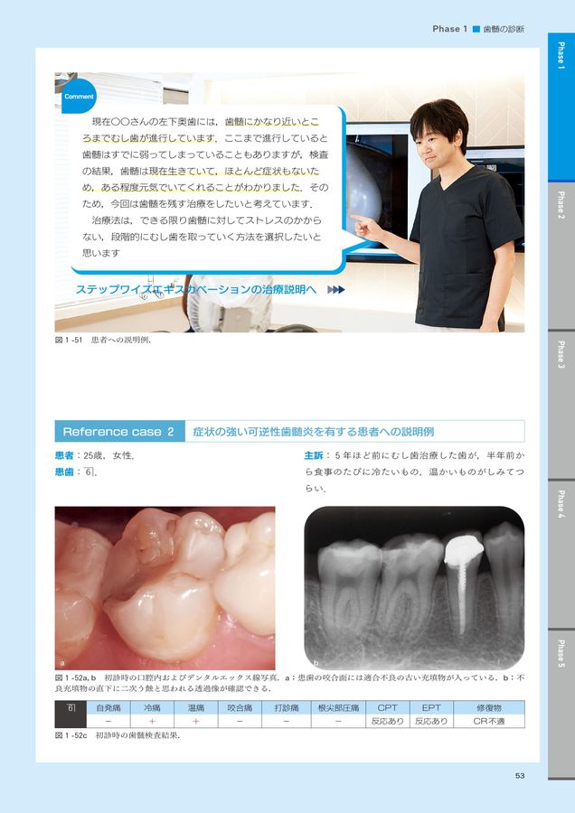 深在性う蝕に対するVital Pulp Therapy