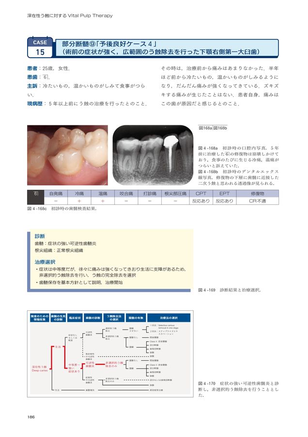 ⚠裁断済　深在性う蝕に対するVital Pulp Therapy　☆ ⚠裁断済 深在性う蝕に対するVital Pulp Therapy ☆ - メルカリ