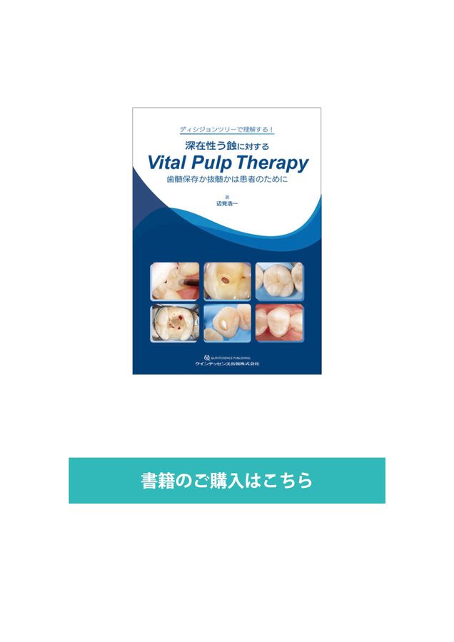 ⚠裁断済　深在性う蝕に対するVital Pulp Therapy　☆ 深在性う蝕に対するVital Pulp Therapy