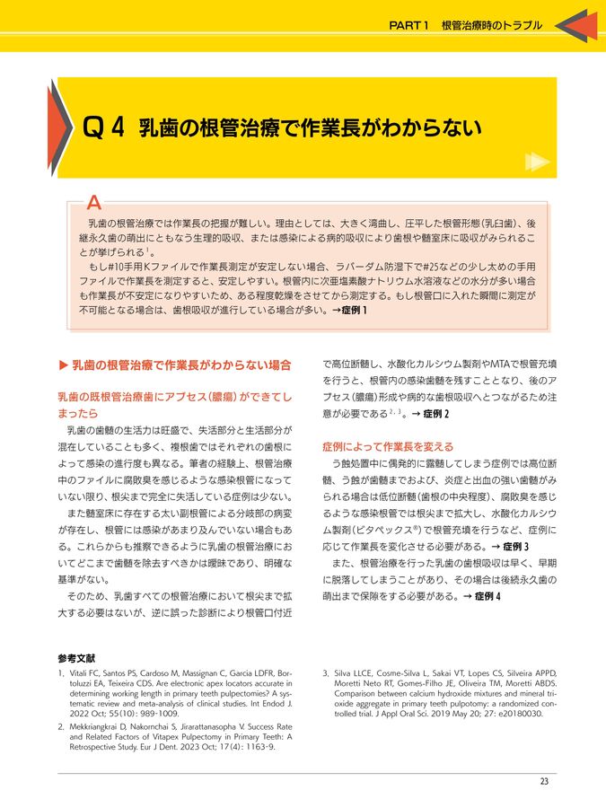 完全解説 根管治療トラブル攻略本