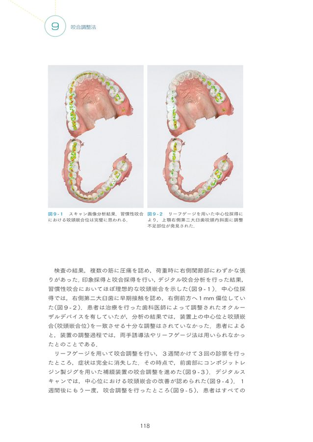 咬合の臨床応用