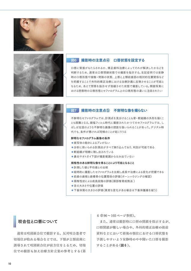 セファログラムの作法と心得