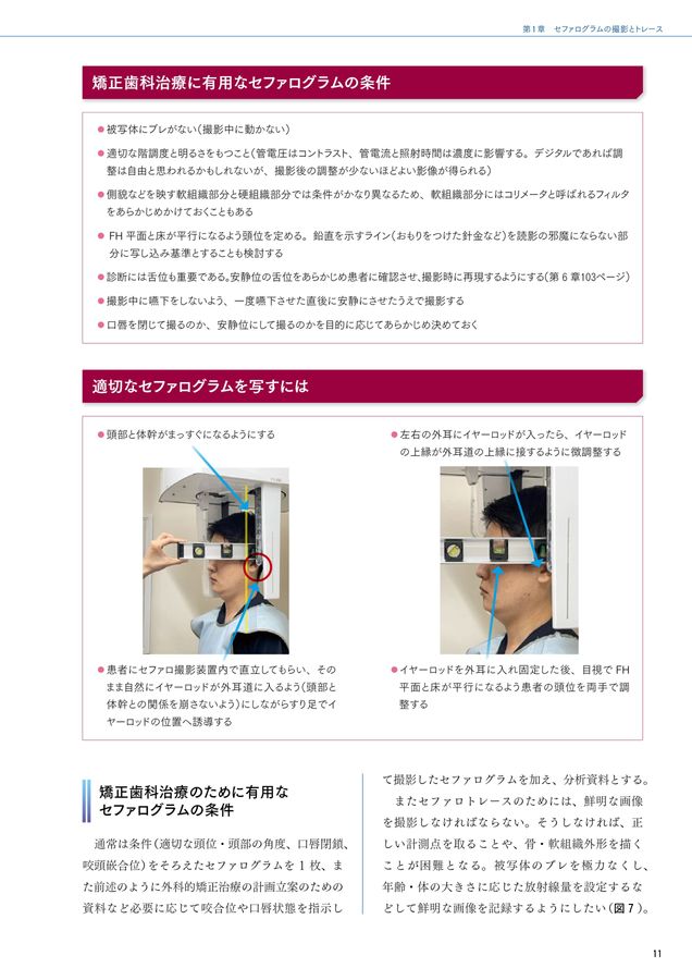 セファログラムの作法と心得