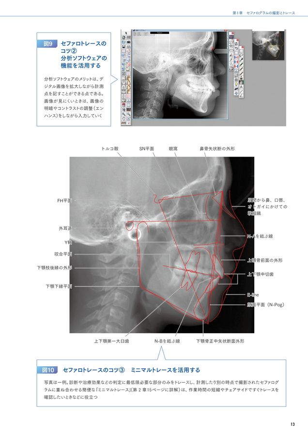 セファログラムの作法と心得
