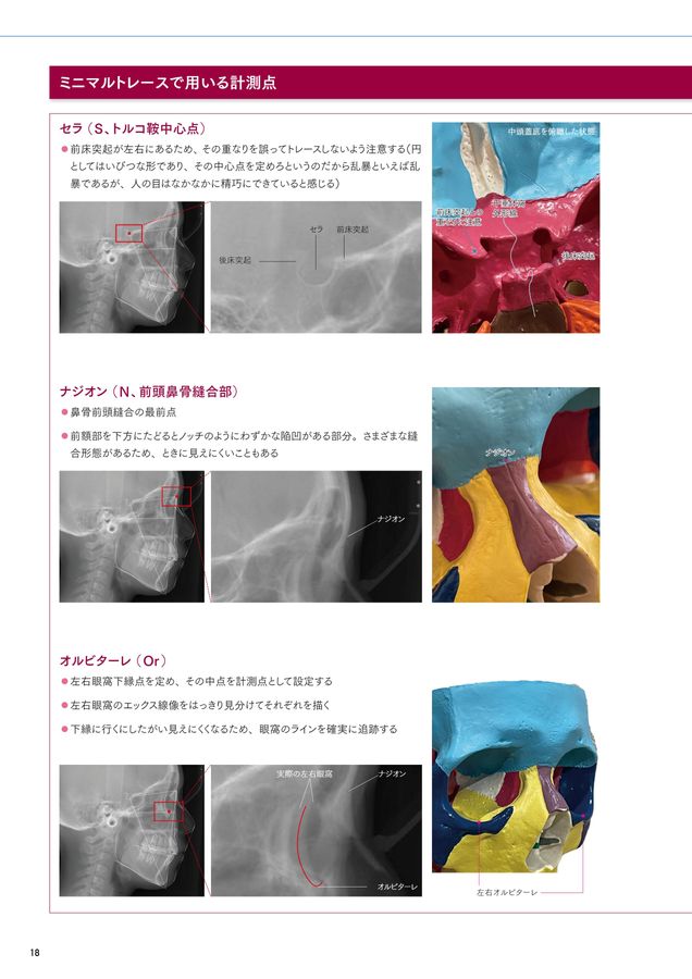 セファログラムの作法と心得