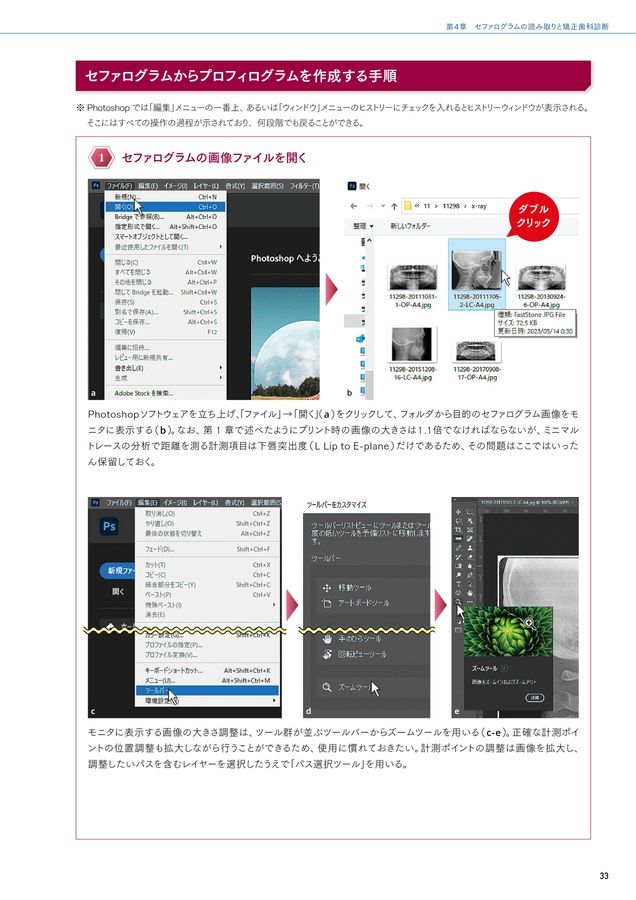 セファログラムの作法と心得