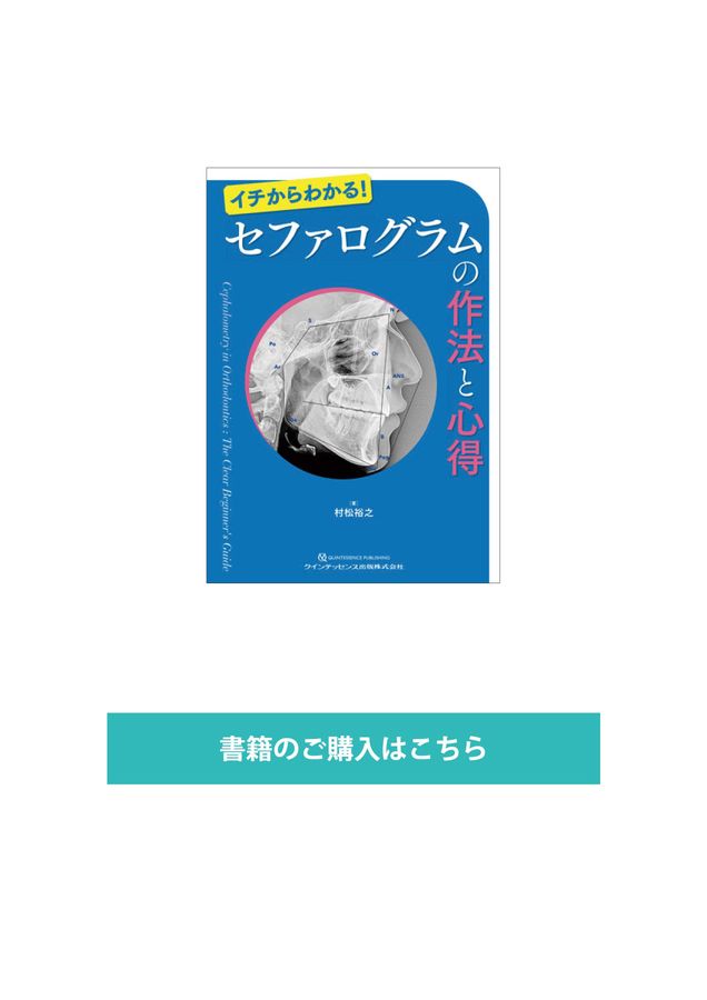 セファログラムの作法心得 セファログラムの作法と心得: イチからわかる! | 村松裕之 |本 | 通販
