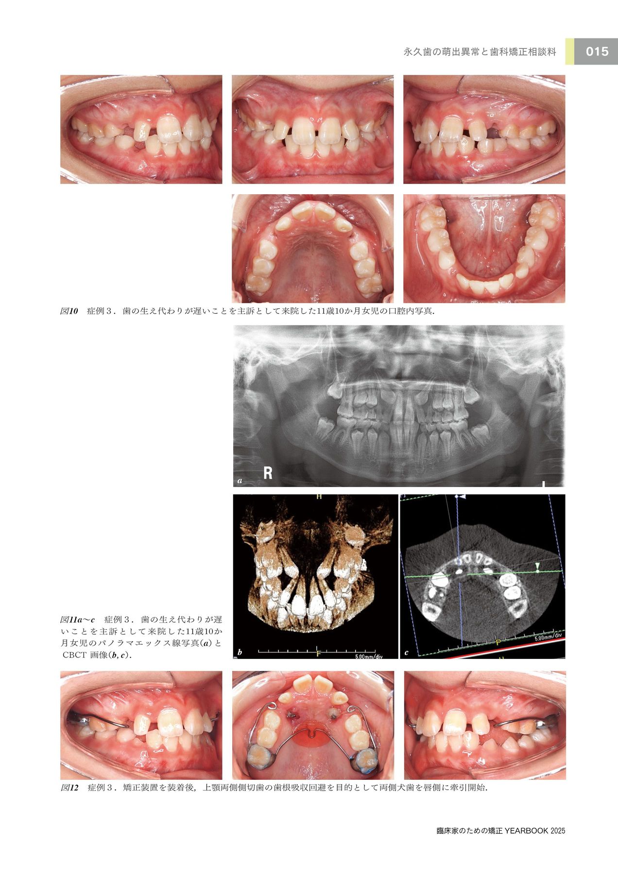 臨床家のための矯正_YEARBOOK2025