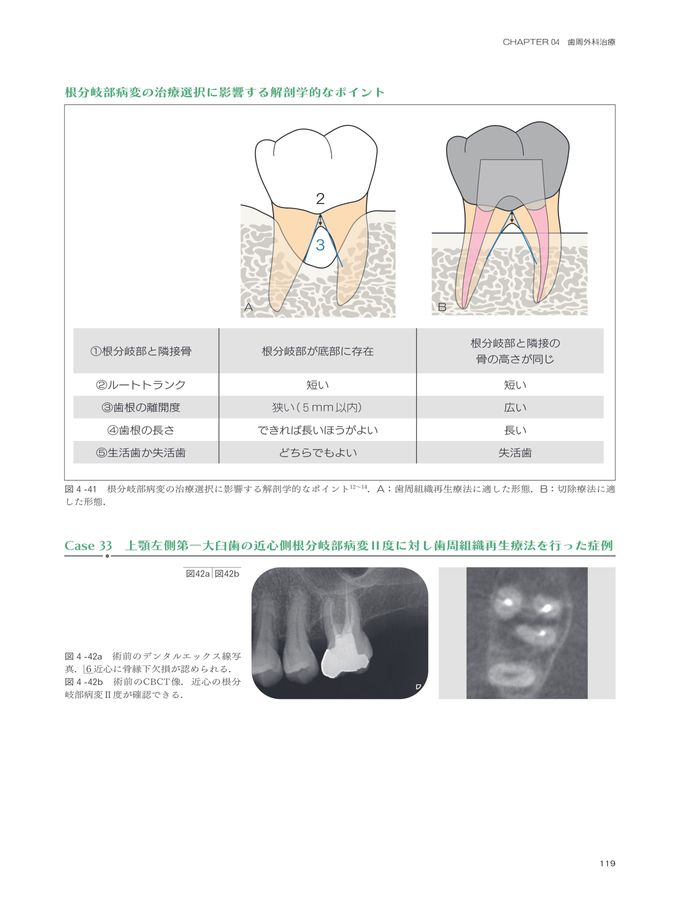 歯周炎ステージⅠ・Ⅱ・Ⅲ診療ガイドライン