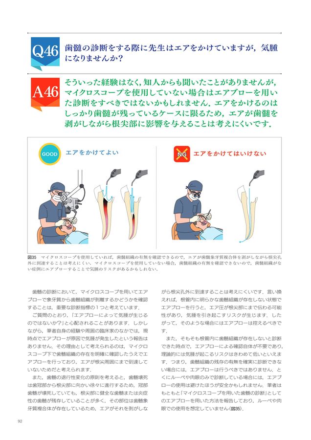 治る歯髄_治らない歯髄_ハイライトQ&A91
