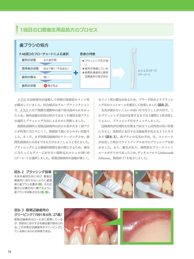 歯ブラシ処方箋2