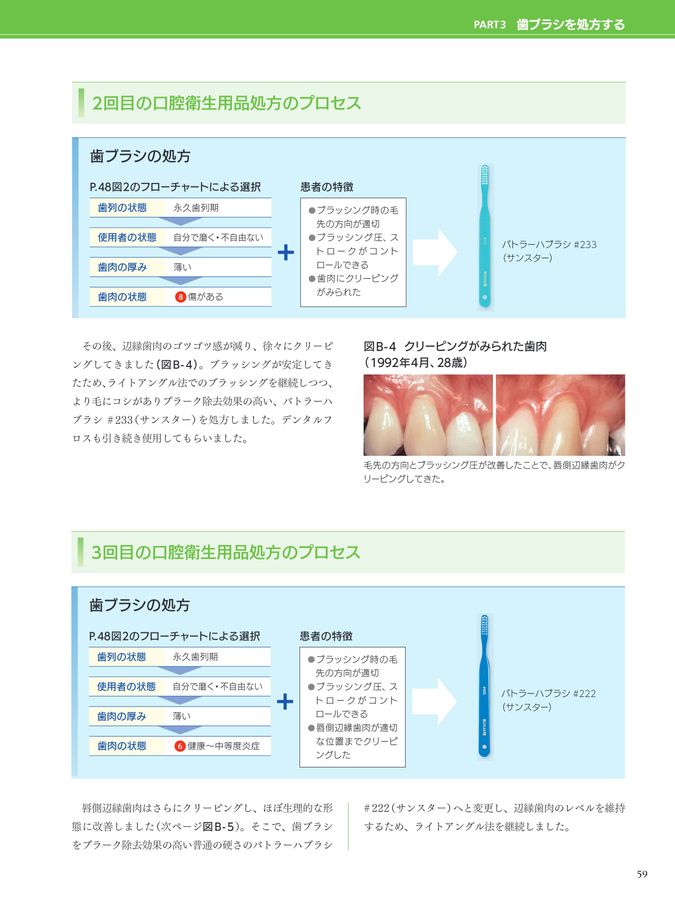 歯ブラシ処方箋2