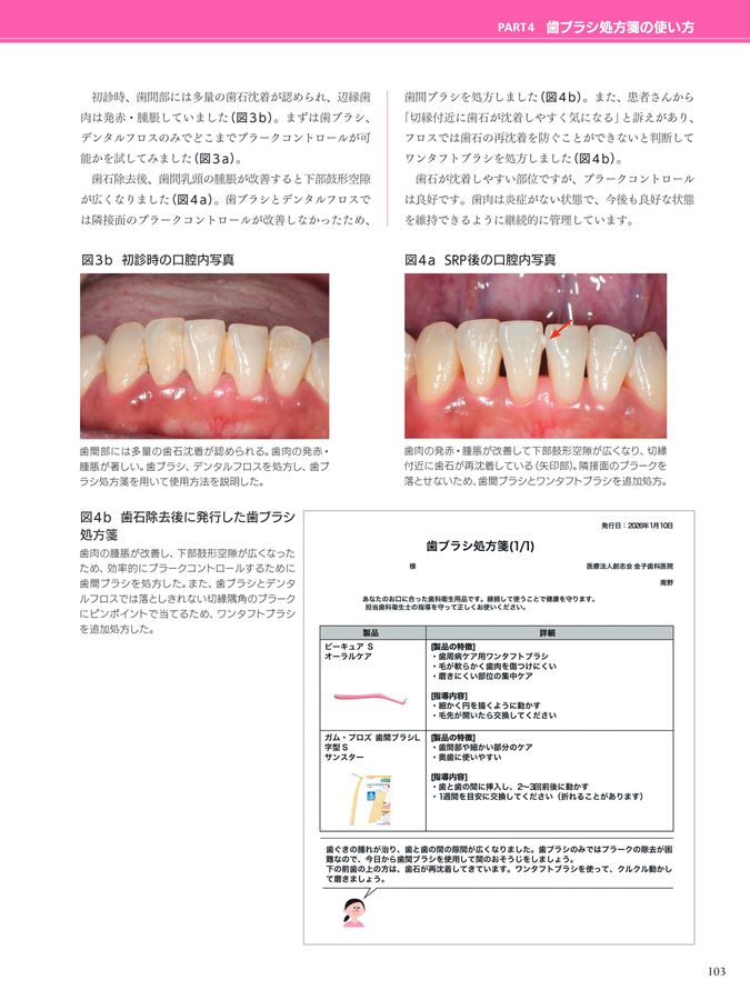 歯ブラシ処方箋2