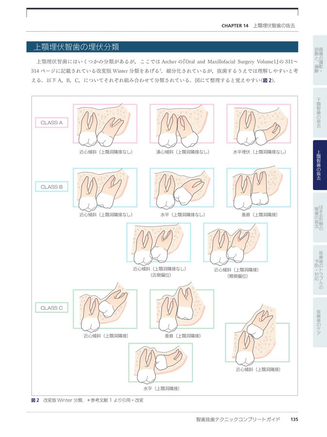 智歯抜歯テクニックコンプリートガイド