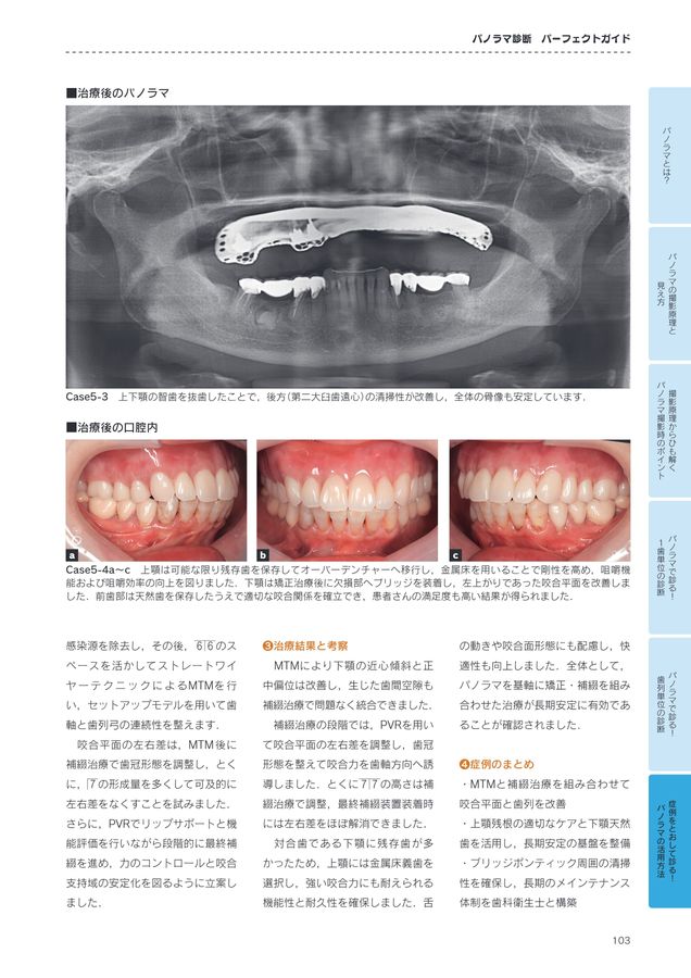 パノラマ診断_パーフェクトガイド